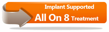 All On 8 Implant Promotion