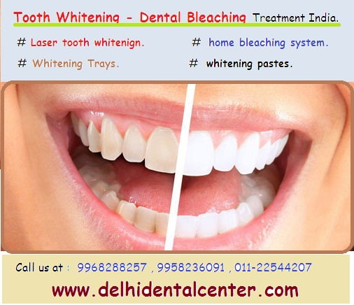 Teeth Whitening Swabs