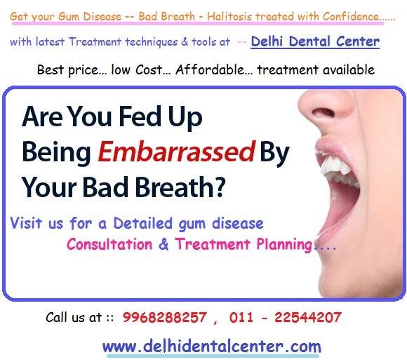 Bad Breath Treatment >> Bad Breath Causes Cures And Treatment Delhidentalcenter Bad Breath Treatment >> Bad Breath Causes Cures And Treatment Delhidentalcenter