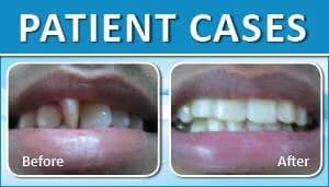 Patient Case 3