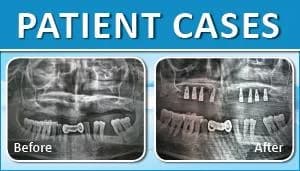 Patient Case 1