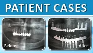 Patient Case 3