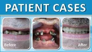 Patient Case 4