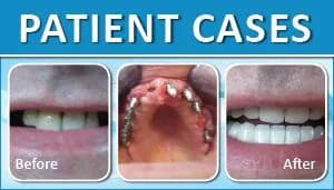 Patient Case 5