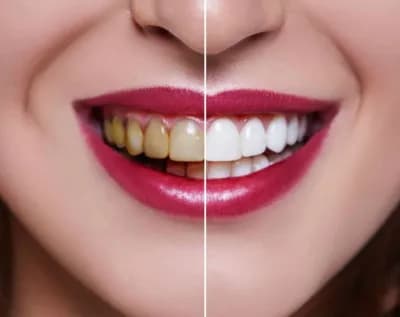 Cosmetic Dentistry