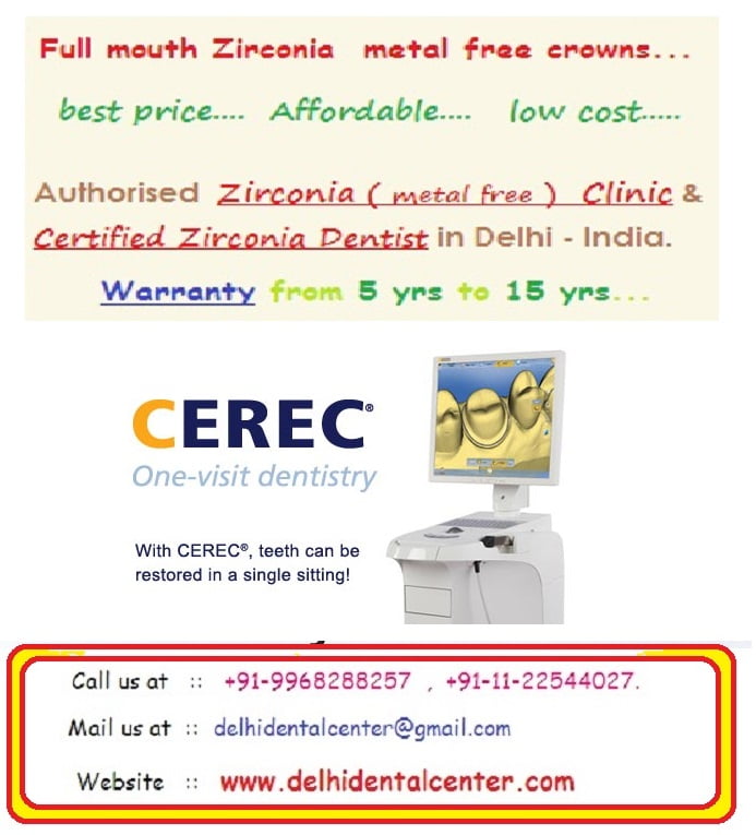 Porcelain Zirconia Ceramic CAD CAM Metal Free Dental Teeth Crowns ...